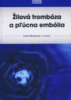 Obrázok - Žilová trombóza a pľúcna embólia