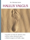 Kniha - Hallux valgus