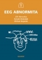Kniha - EEG abnormita